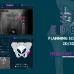 2D/3D preoperative planning solution