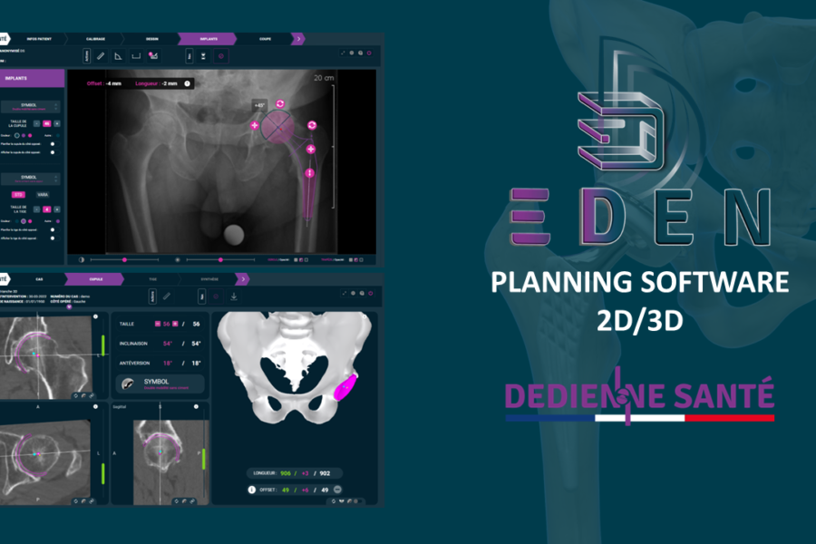 EDEN, the 2D/3D preoperative planning solution by DEDIENNE SANTE