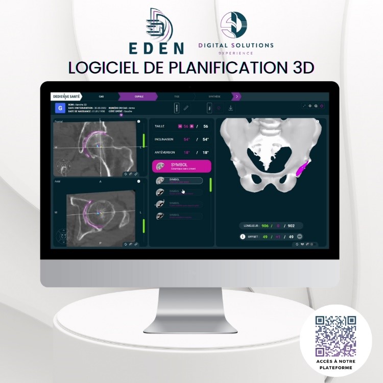 Logiciel de planification 3D